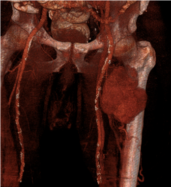 Clinical case: Soft tissue tumor